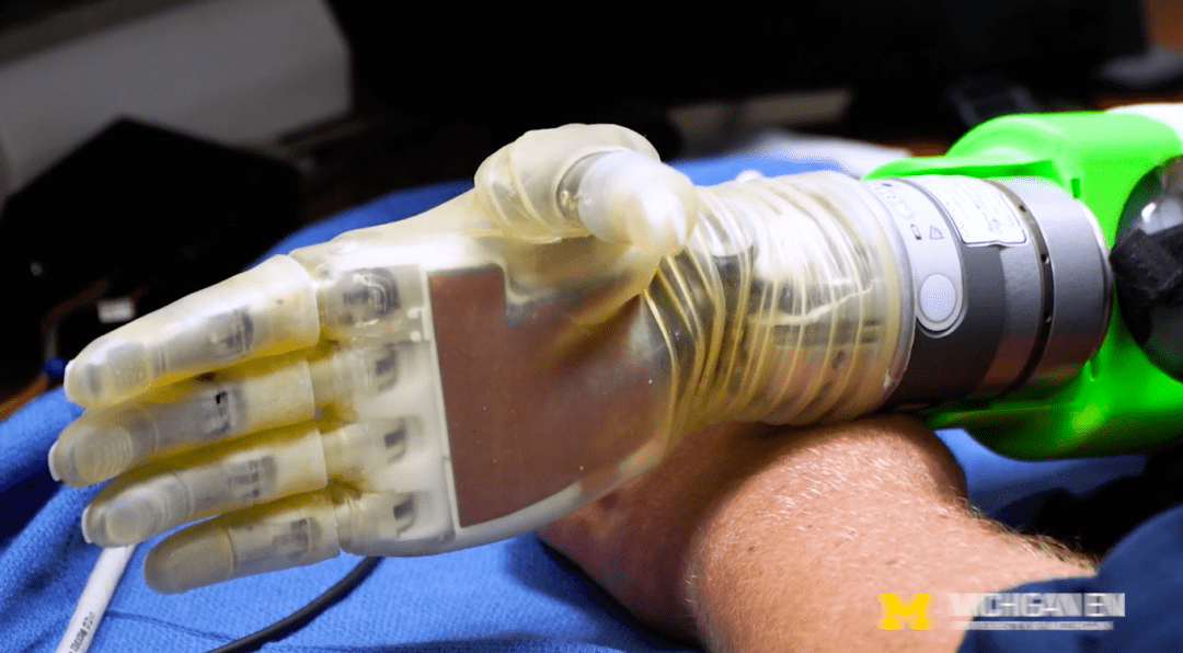 Создали интуитивный нейропротез, который всему учится сам