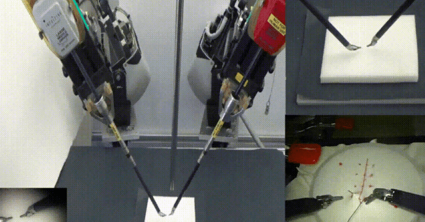 ИИ научился зашивать раны, посмотрев видео с операций