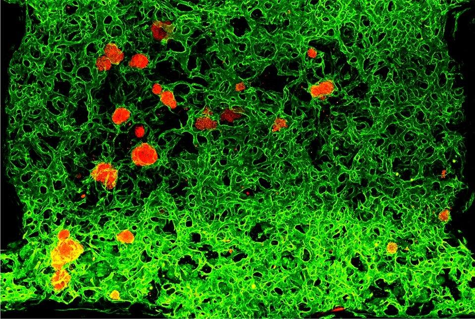 Новый метод создания работающих кровеносных сосудов