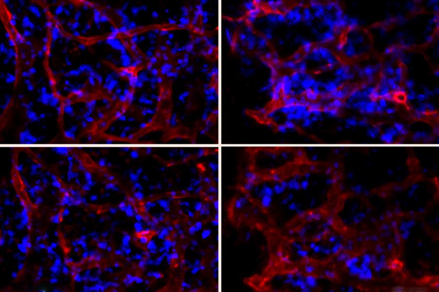 Создали наночастицы, которые умеют отключать гены костного мозга