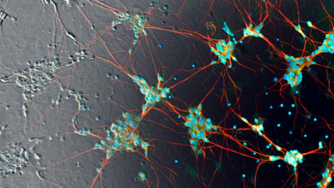 ИИ научился изучать живые клетки