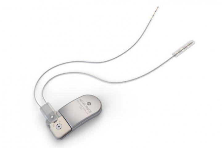 Изобрели: мозговой имплант, который предсказывает приступы эпилепсии