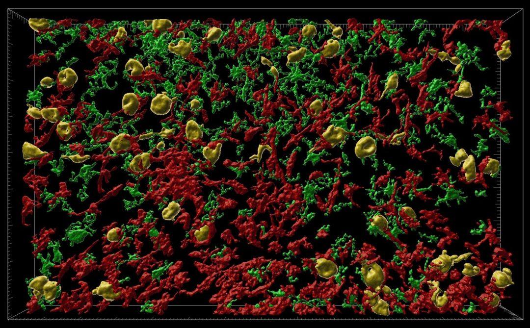 Разработали модель ранних стадий болезни Альцгеймера