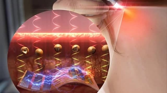 [Изобрели] новый способ доставлять лекарства в организм без уколов