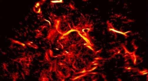 [Изобрели] новый вид микроскопии сосудов головного мозга