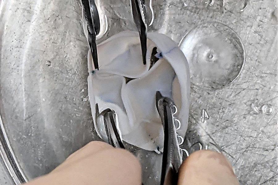 Сердечный клапан, который растёт вместе с носителем