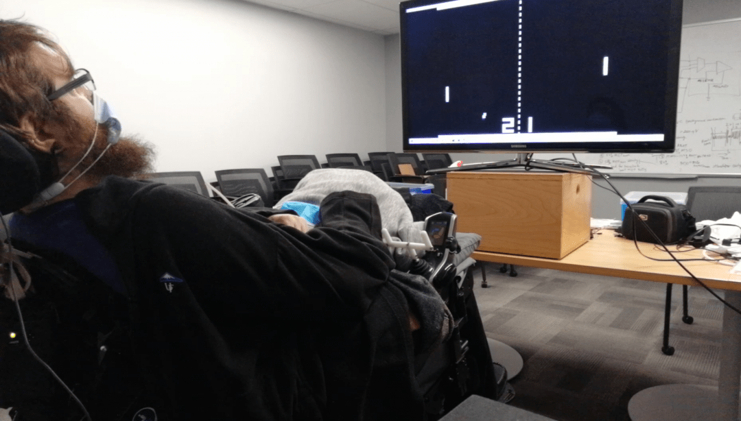 Пациент с мозговым имплантом бросил вызов обезьяне Neuralink