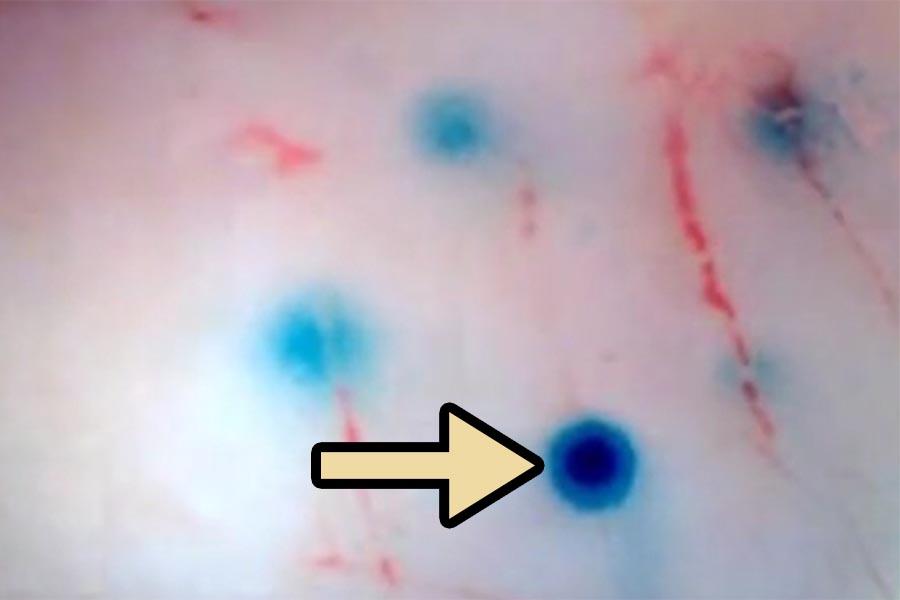 Крошечные роботы доставляют лекарства прямо в нервную систему