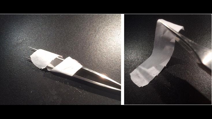 Разработали биоимплант для лечения повреждений и заболеваний сухожилий