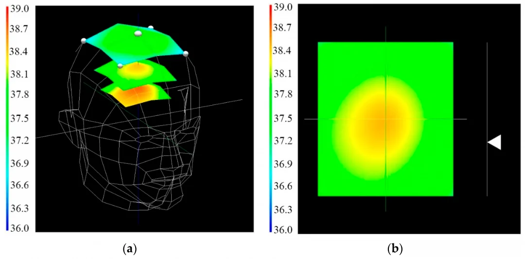 В России придумали обнаруживать опухоли по температуре тела