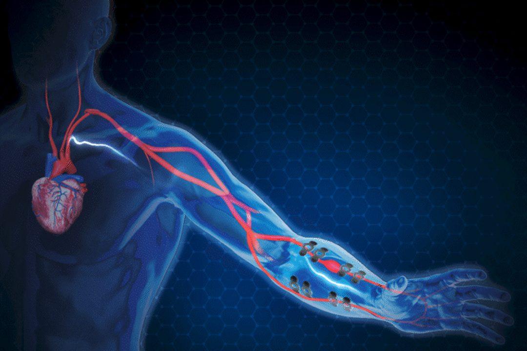Создали временные татуировки из графена для измерения давления