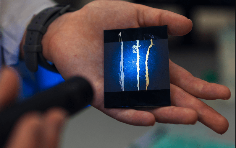 В России сделали медицинский материал, который реагирует на заражение ран