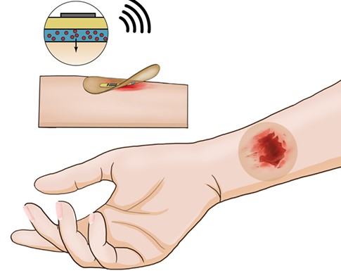 Создали умный пластырь, который заживляет раны при помощи тока