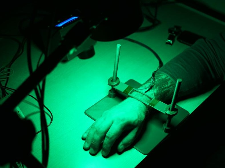 В России изобрели новый бесконтактный метод проверки кровеносных сосудов