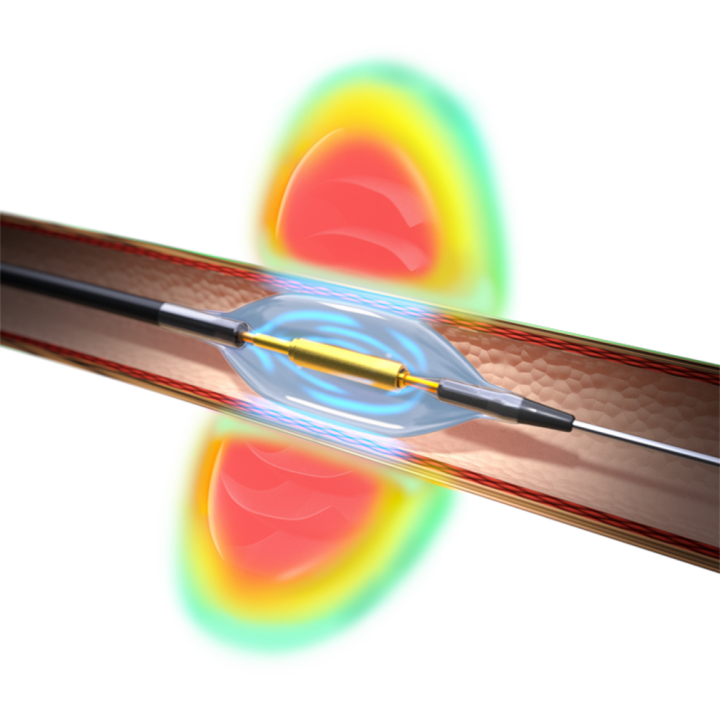 Сделали устройство, которое лечит гипертонию при помощи ультразвука