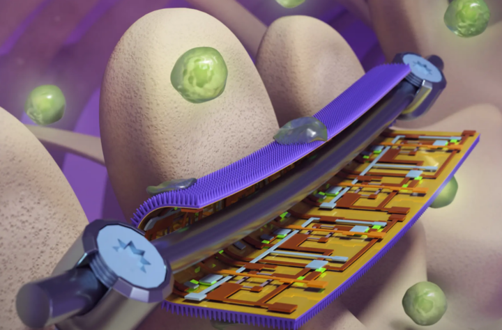 Придумали, как бороться с инфекциями на имплантатах, подсмотрев решение у насекомых