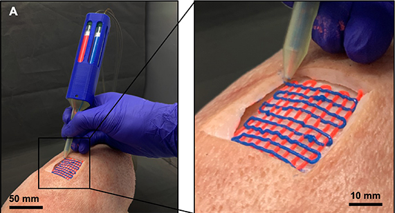 Создали портативный биопринтер для печати тканей и органов внутри тела
