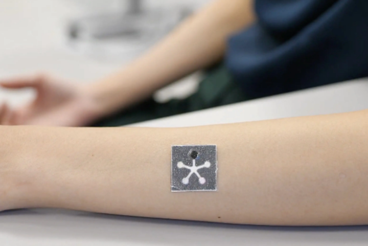 Разработали умный пластырь, который отслеживает 5 показателей состояния раны