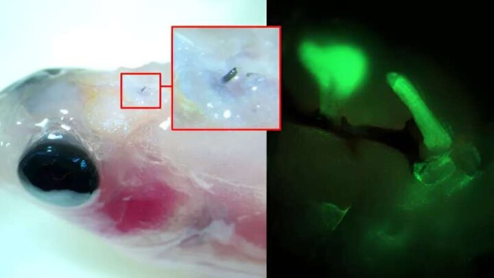 Изобрели временные органические электроды, которые вводятся в организм без хирургической операции