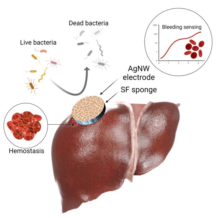Создали универсальное устройство, которое останавливает кровотечение и отслеживает состояние раны