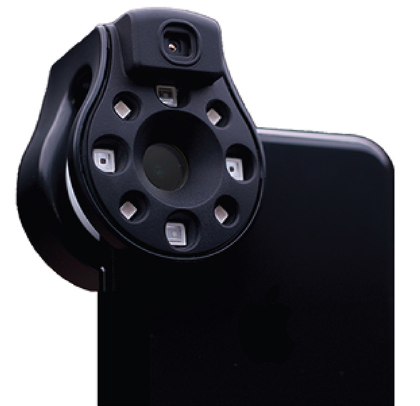 Изобрели недорогое устройство, которое крепится к смартфону и быстро выявляет инфекции в ране