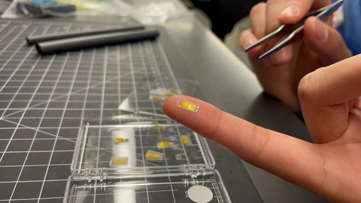 Разработали имплантат, который следит за пересаженным органом и обнаруживает ранние признаки его отторжения